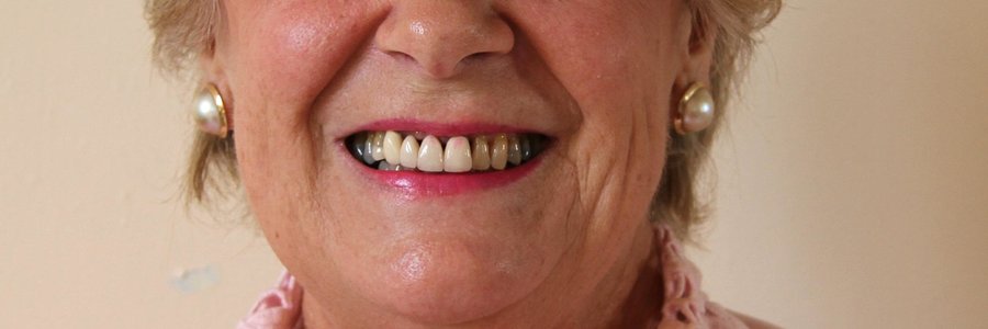 Alderlady Nicolette  Botha-Guthrie  Overstrand Executive Mayor